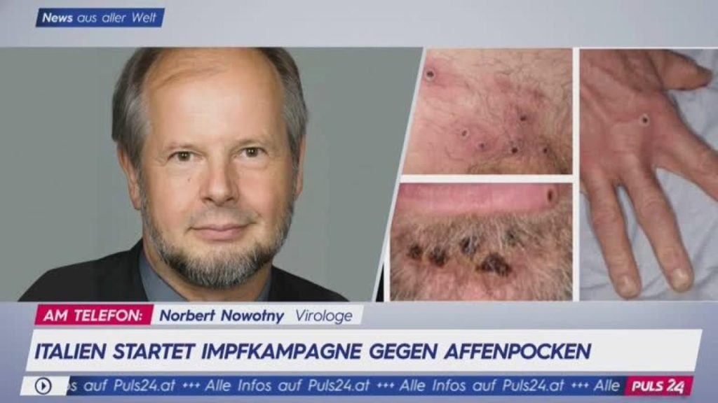 Virologist Norbert Nowotny: Mass vaccination against monkeypox is not necessary