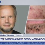 Virologist Norbert Nowotny: Mass vaccination against monkeypox is not necessary